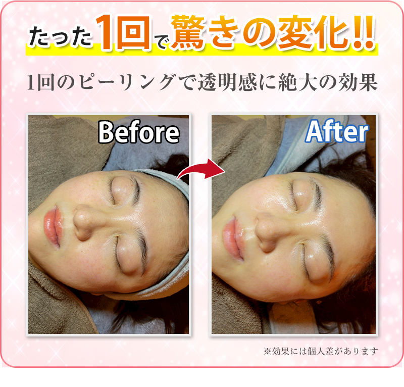 ビフォーアフター